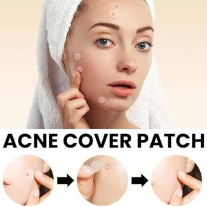 Acne Cover Patch (72pc)